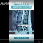 你知道腰椎间盘突出物是什么样子吗？
