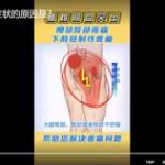 腰突引起下肢症状的原因是？