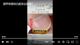 指甲有竖纹有凸起怎么回事？