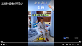 三叉神经痛射频治疗