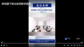 蛛网膜下腔出血例教学查房