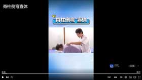 脊柱侧弯查体