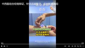 中西医结合经络辨证针灸远端取穴应对眩晕胸闷
