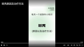 斑秃原因及治疗方法
