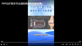 PRP治疗骨关节炎减轻疼痛和功能改善
