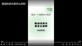 脂溢性皮炎是怎么来的？