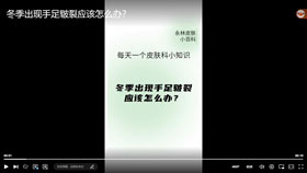 冬季出现手足皲裂应该怎么办？