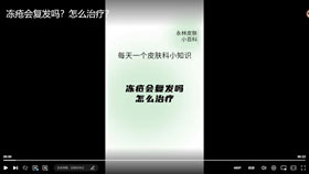冻疮会复发吗？怎么治疗？