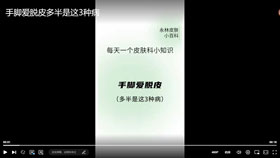 手脚爱脱皮多半是这3种病