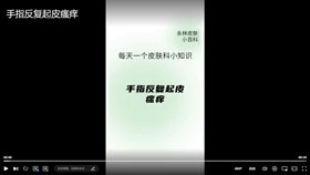 手指反复起皮瘙痒