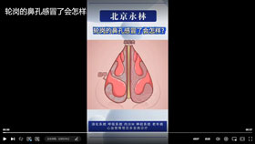 轮岗的鼻孔感冒了会怎样？